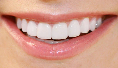 Cách để có hàm răng đẹp bền lâu